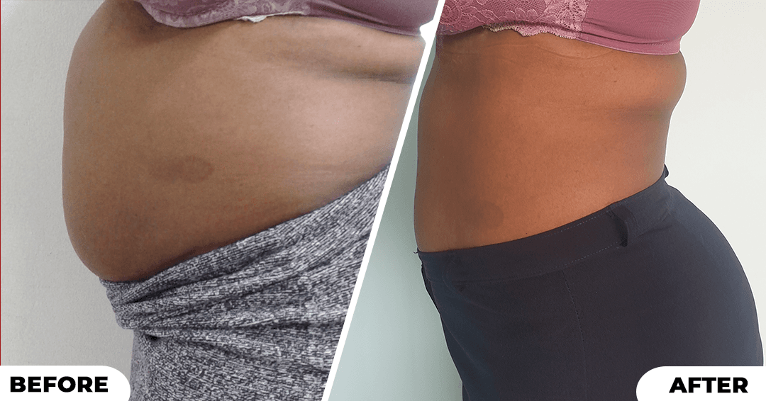 Natural Weight Loss for Stubborn Belly Fat in Jamaica