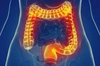 Gut Health Restoration image