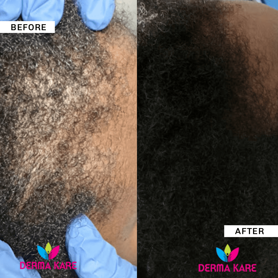 Hair Loss Reversal and Restoration image