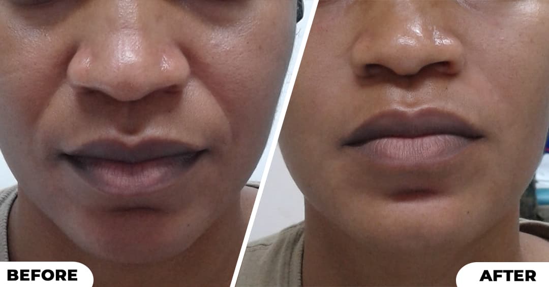 Aesthetic Treatments image